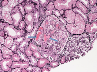 December%202018%20case%201
