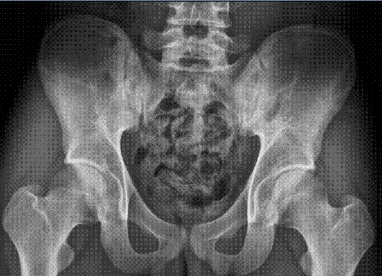 December%202018%20case%201