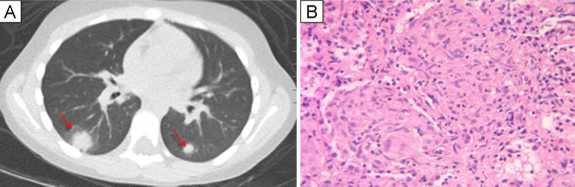 Screen%20Shot%202020 11-17%20at%201.31.12%20PM
