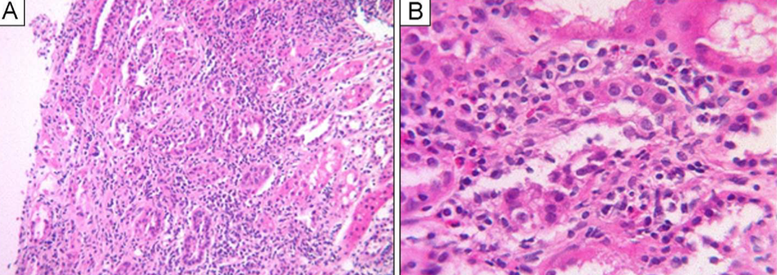 Screen%20Shot%202020 11-17%20at%201.34.51%20PM